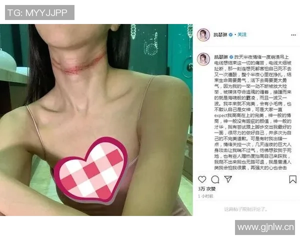 普理查德揭露训练营对抗激烈程度颈部血痕见证战斗般的拼搏精神